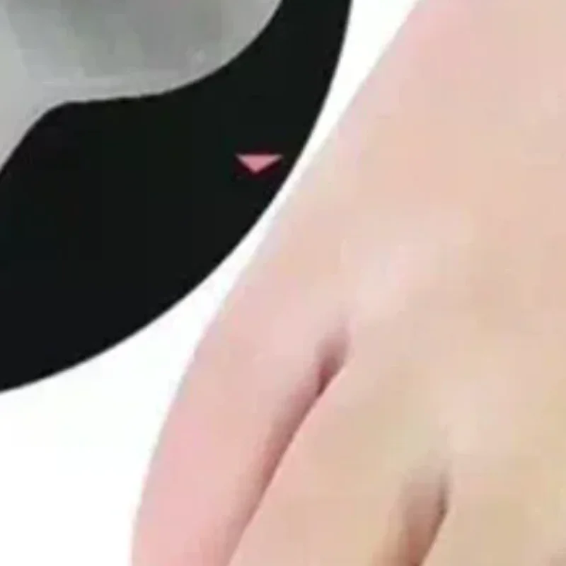 2PCS toe eversion protector, silicone double ring thumb correction device, separate finger correction device, adjuster