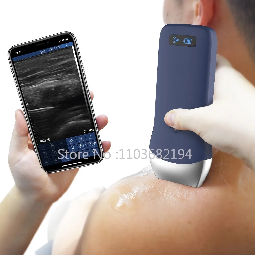 Viatom Wifi Mini Ge Ultrasound Device Linear Probe Sonoscape Ultrasound