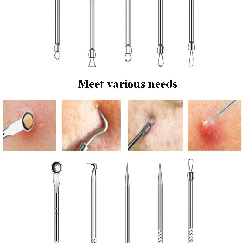 にきび除去針,にきび除去針,毛穴クリーナー,ディープクレンジングツール,フェイシャルスキンケア,3個,4個,5個,8個