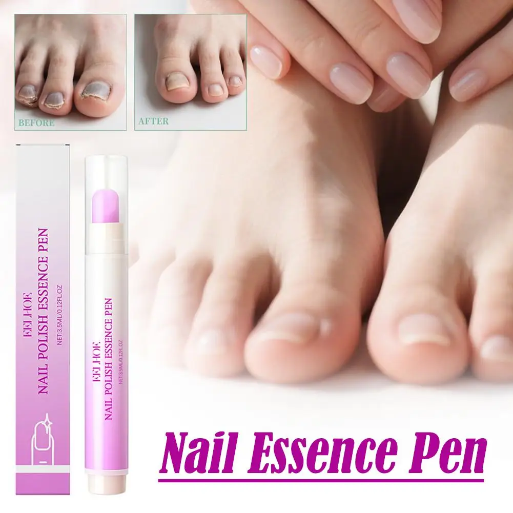 قلم إصلاح عدوى الأظافر مضاد لفرط الأظافر بارونيشيا اصفرار تحسين إزالة الفطريات القلم أظافر ملونة أظافر C H1I9 #6