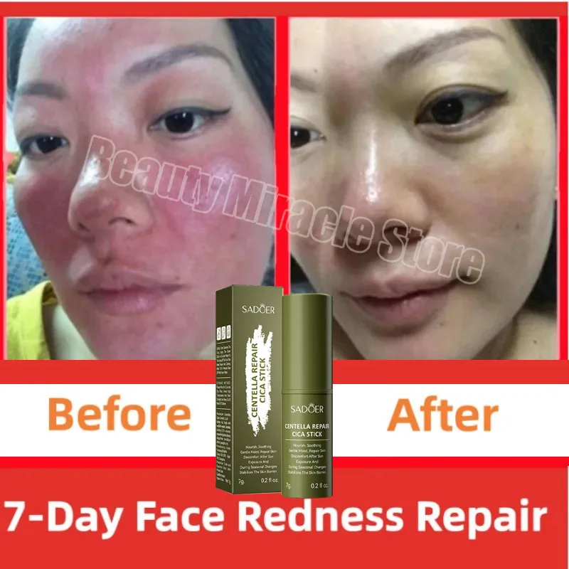 Instant Repair Facial Redness Multi Bounce Balm Face Sensitive Skin Treatment Korean Anti Red Nose Balm Stick Skin Care Products