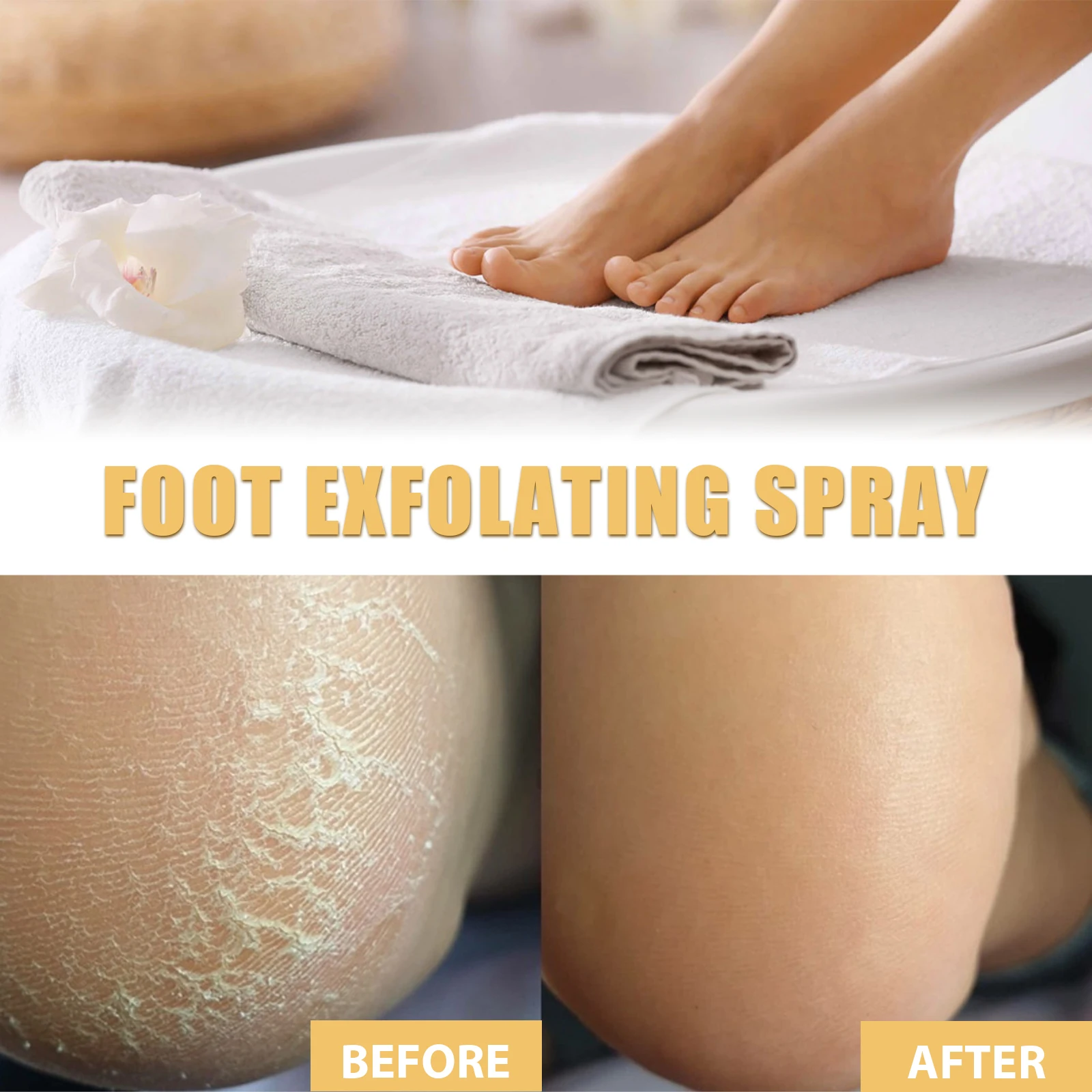 Thumbnail 4 - #25 Dead Skin Removers List of Top Picks