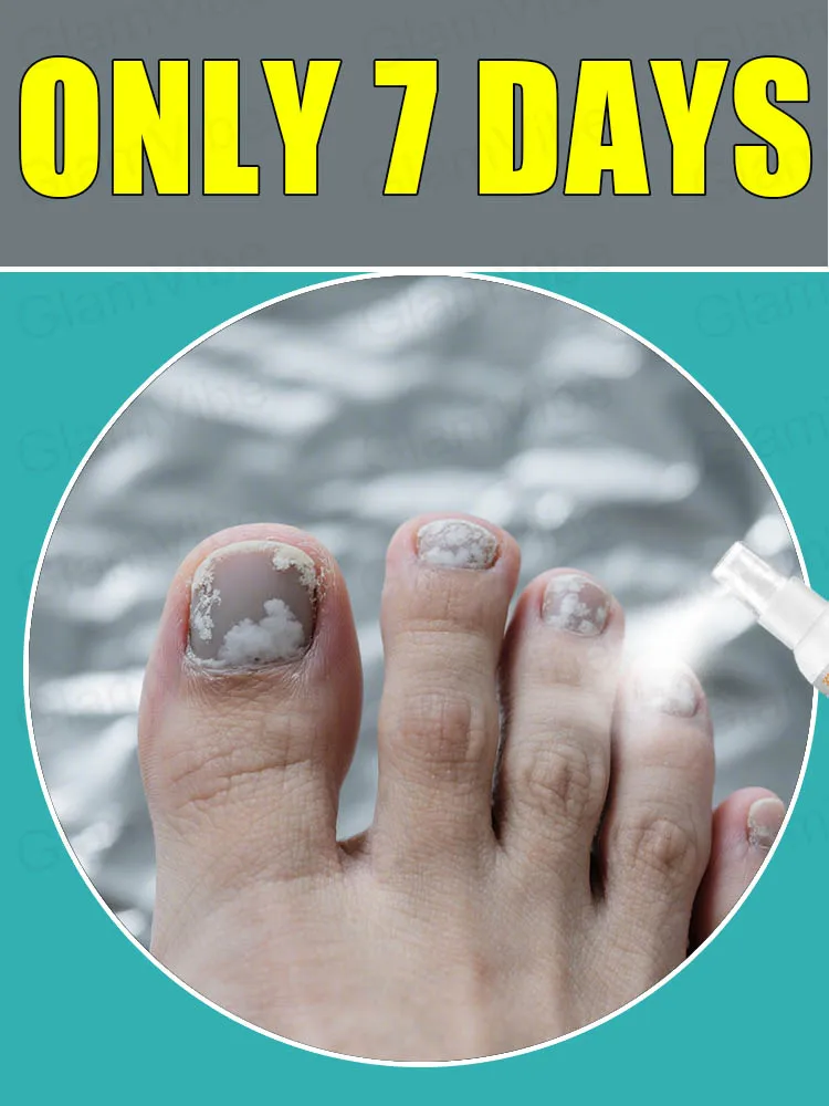 ᴬᵈᵛᵃⁿᶜᵉᵈ ᶠᵘⁿᵍᵃˡ ᴺᵃⁱˡ ᴿᵉᵖᵃⁱʳ ᔆᵖʳᵃʸ⸴ ᴴᵉʳᵇᵃˡ ᶠᵒʳᵐᵘˡᵃ⸴ ᴼⁿˡʸ ⁷ ᴰᵃʸˢ