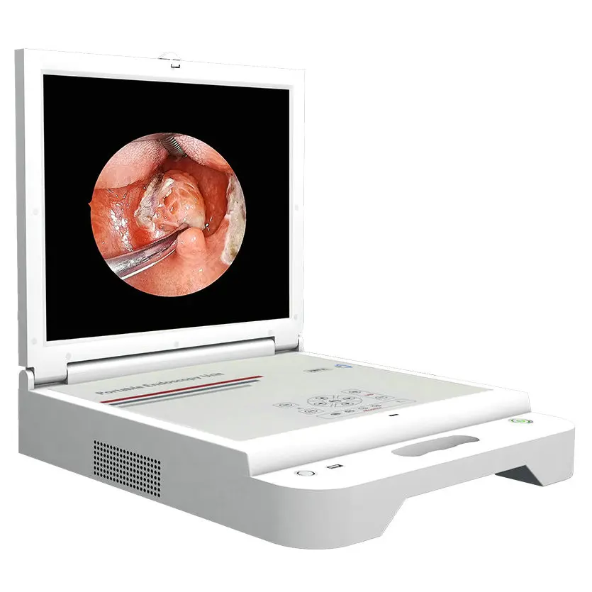 2026 New All-in-one Endoscope Camera System For ENT Urology Arthroscope Rigid Portable