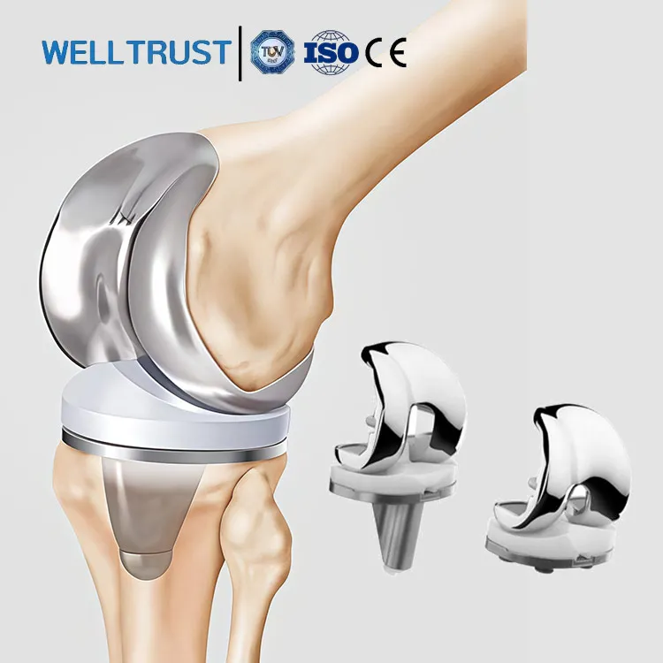 CE Certified Arthroplasty Artificial Knee Joint Prosthesis CoCrMo Alloy Orthopedic Implants Primary Total Knee Replacement Kit
