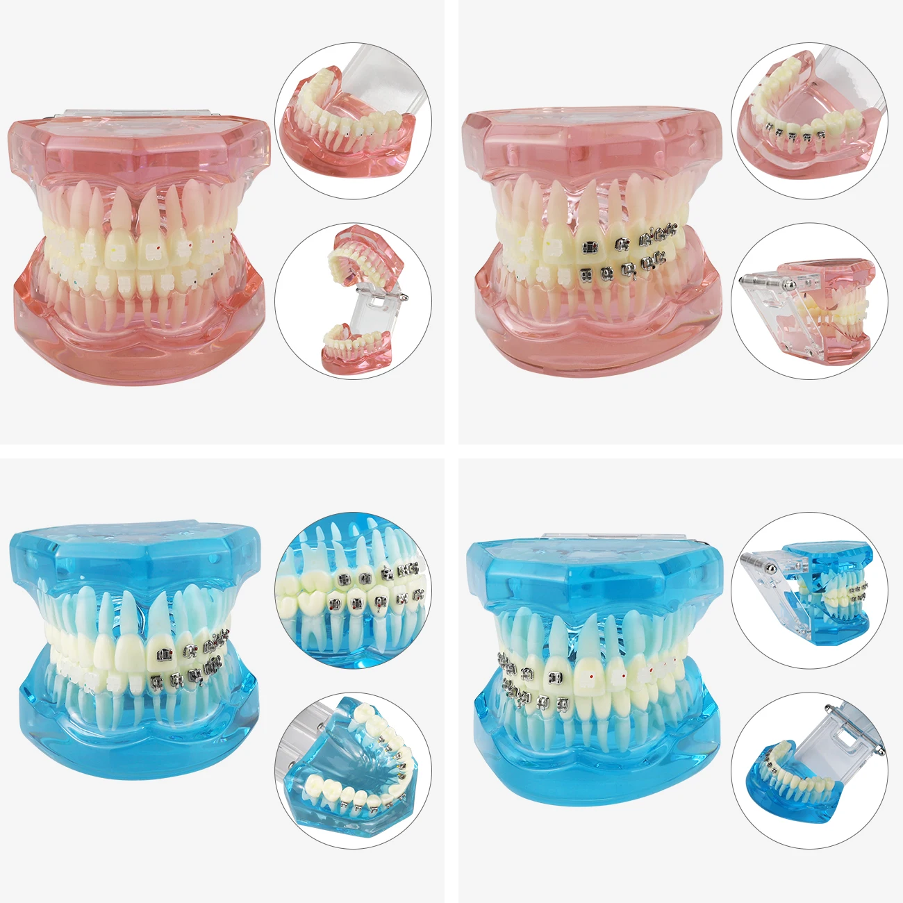 Nowa choroba implantu dentystycznego Model zębów Model ortodontyczny nauczanie nauka medyczna praktyka ortodoncja Model leczenia