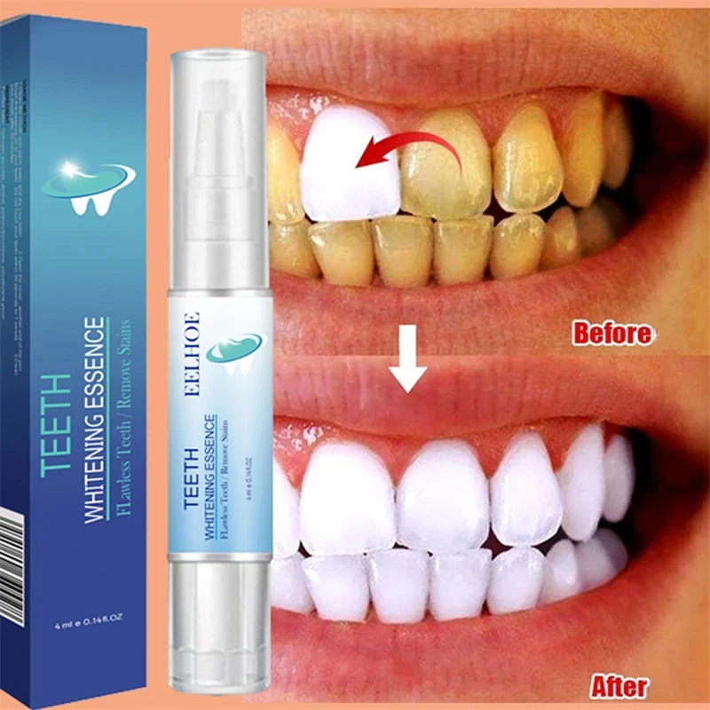 Teeth Whitening Essence Remove Plaque Stains Oral Hygiene Bleaching Product Clean Fresh Breath Dentistry Care Blanqueador Dental