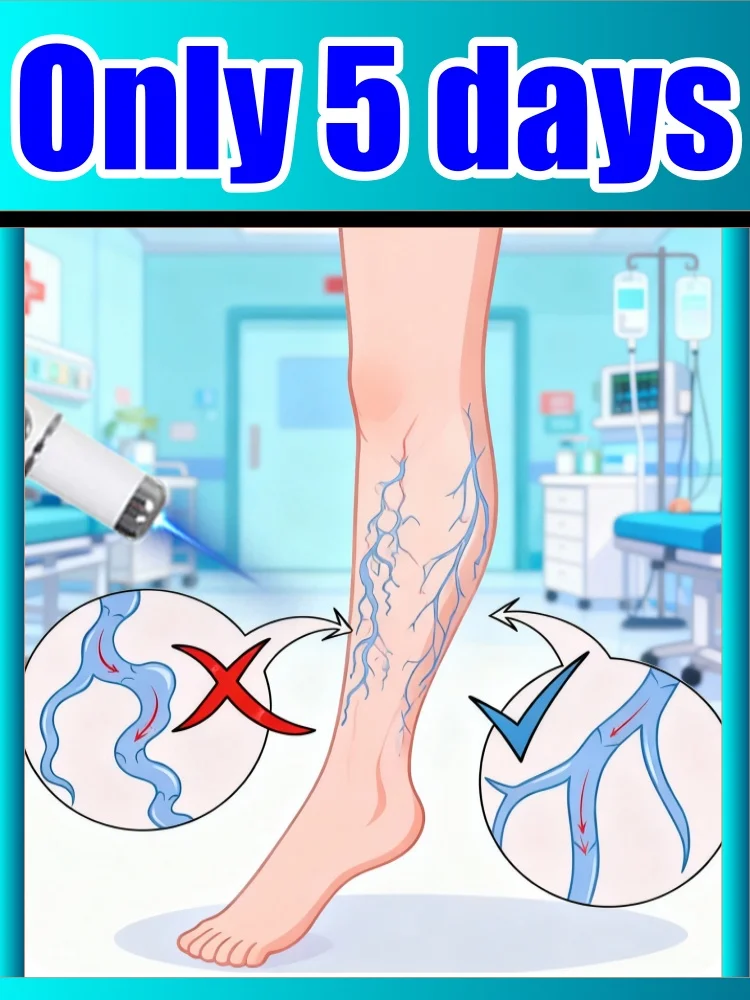 

A care kit for varicose in the legs, on special offer for a limited time