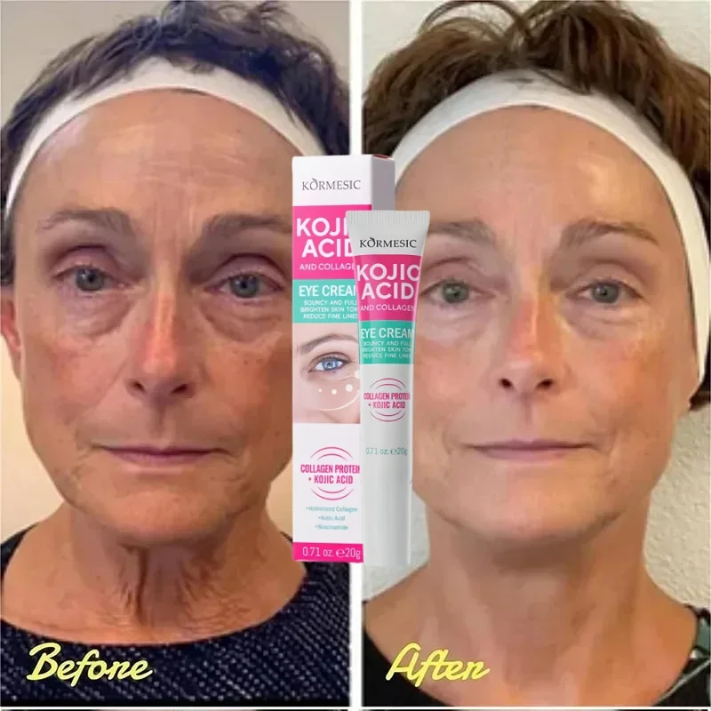 인스턴트 아이 백 제거 크림 콜라겐 안티 링클 퍼밍 스킨 페이드 파인 라인 안티 다크 서클 붓기 밝게 아이 케어