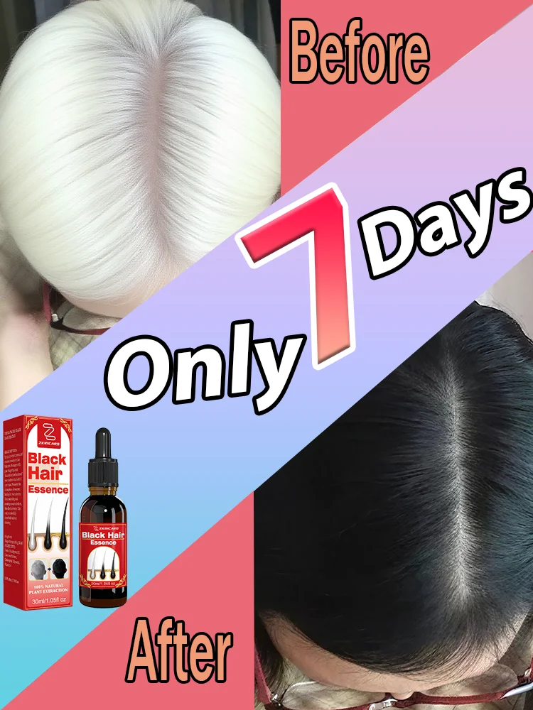 

White to Black Hair Serum Gʀᴀʏ Hᴀɪʀ Tʀᴇᴀᴛᴍᴇɴᴛ Nᴀᴛᴜʀᴀʟ Cᴏʟᴏʀ Rᴇᴘᴀɪʀ Nᴏᴜʀɪsʜɪɴɢ Aɴᴛɪ-Hᴀɪʀ Lᴏss Cᴀʀᴇ Mᴇɴ Wᴏᴍᴇɴ