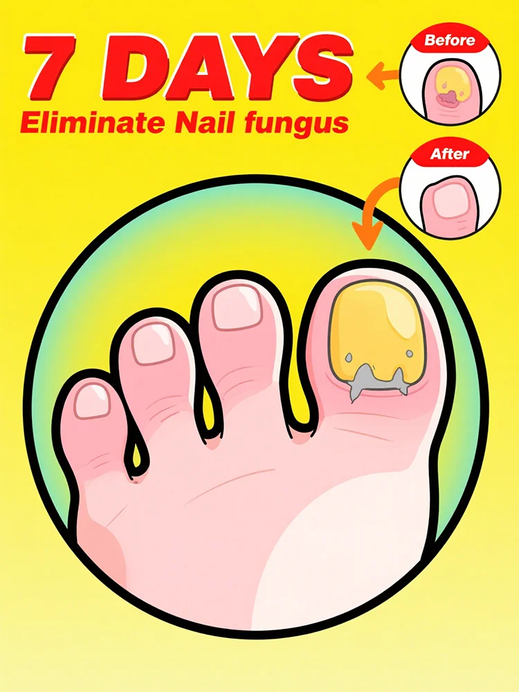 

Quickly eliminate fungus and restore healthy nails