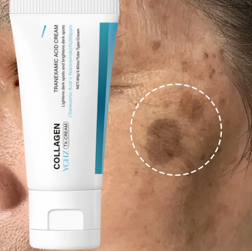 Hyaluronic Acid Face Cream - Contains Niacinamide, Ceramide Skin Care Essence - Long-Lasting Hydration and Moisture Retention - Skin Is Shiny and Smooth - Daily Moisturizing Cream, Korean Skincare - Hypoallergenic - Al