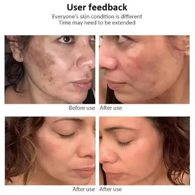 New version of facial essence can whiten, lighten, moisturize, and effectively fade and reduce black spots