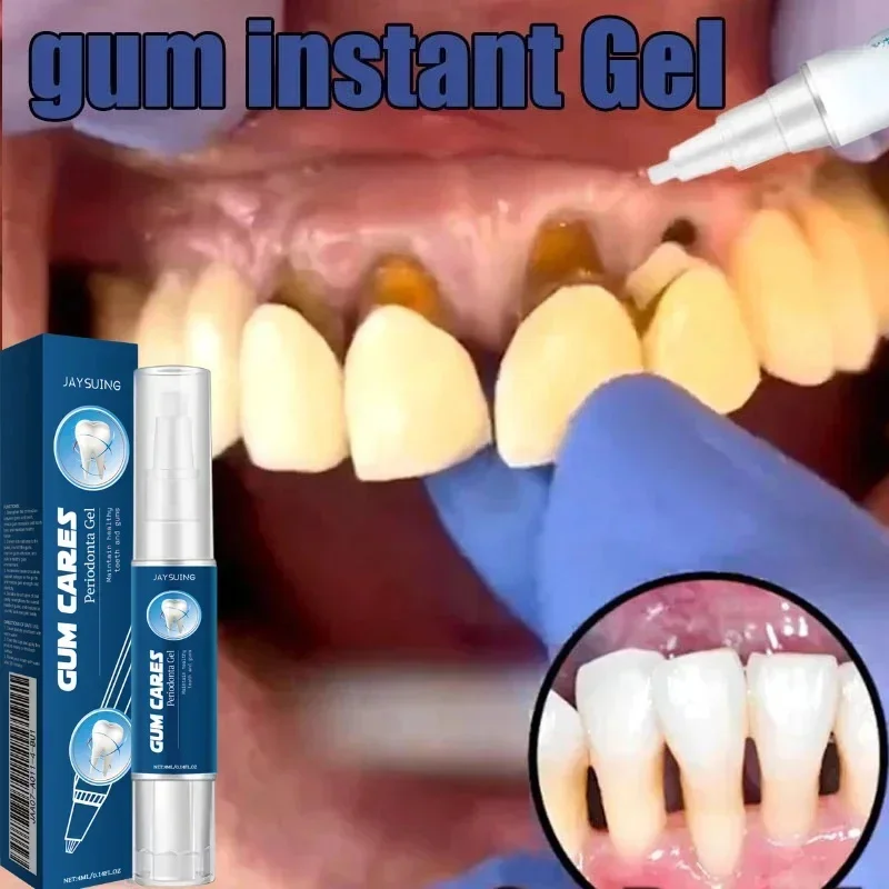 

Rapid Repair Damaged Gums Gel Serum Relieve Sore Tooth Allergy Dental Caries Tooth Cleaning Toothpaste Deep Cleaning Teeth Stain