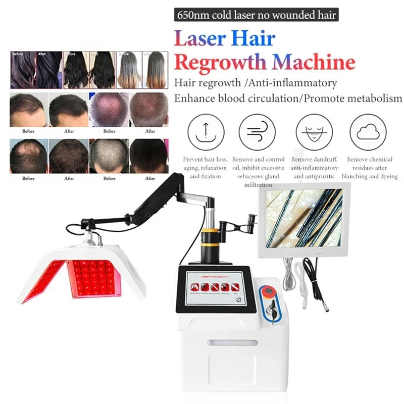 Equipamento de rebrota do cabelo do laser, 5 em 1 diodo, Baixo nível 650nm, Laser frio, Crescimento do cabelo para o folículo capilar proativado, Crescimento rápido