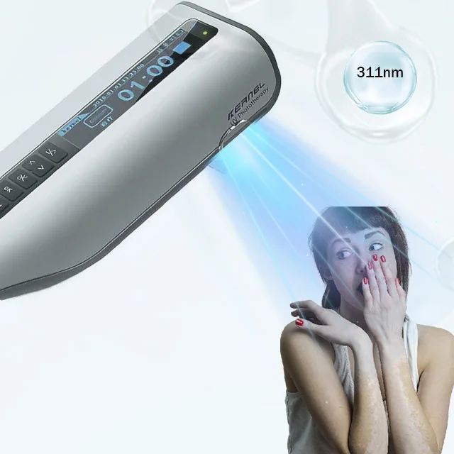 

Kernel KN-4006BL 311nm UVB Light Therapy Handheld Vitiligo Phototherapy Device for vitiligo psoriasis treatment