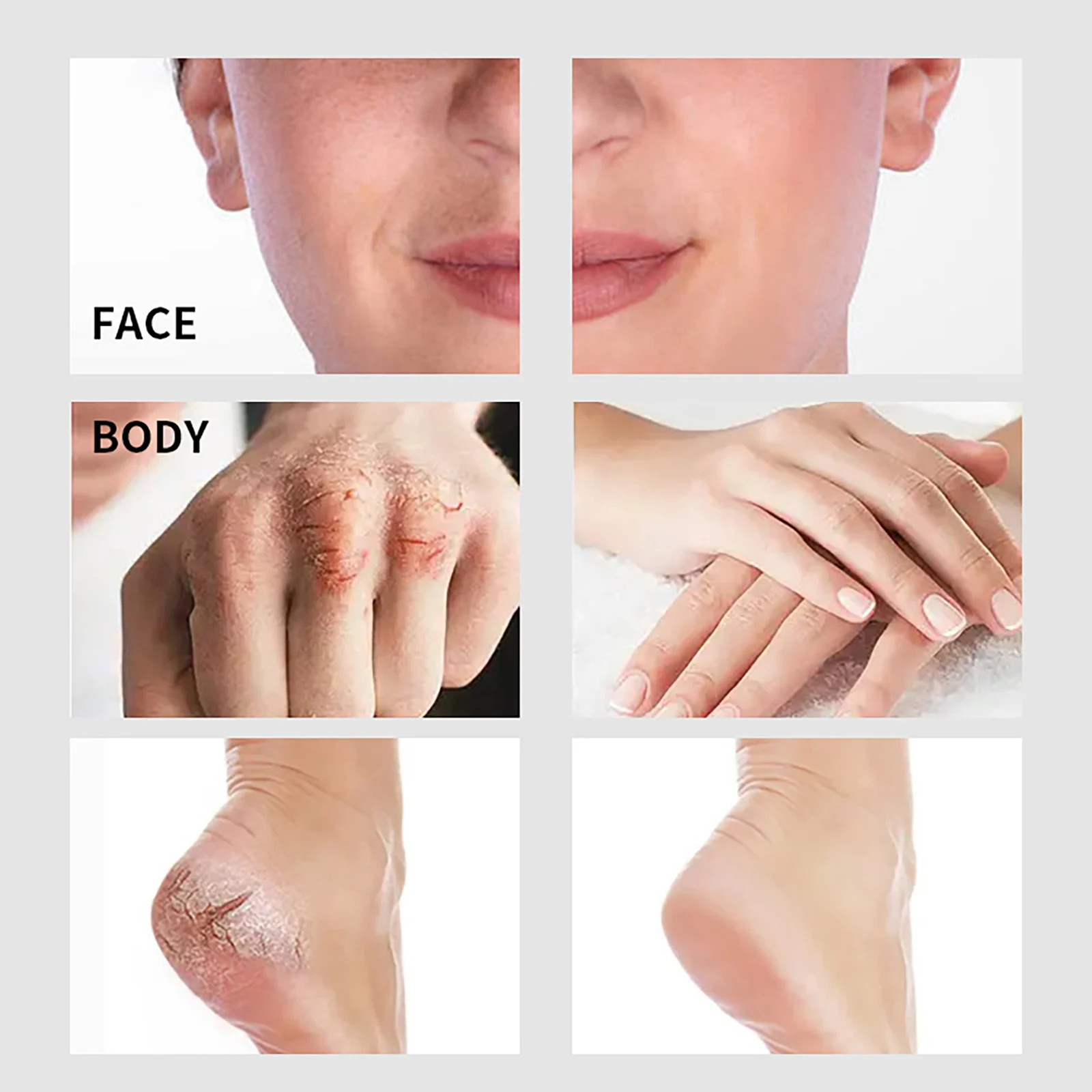 Ailke-保湿美白クリーム,美白クリーム,エンハンサー,ビタミンA,顔の体と手,滑らかで柔らかく