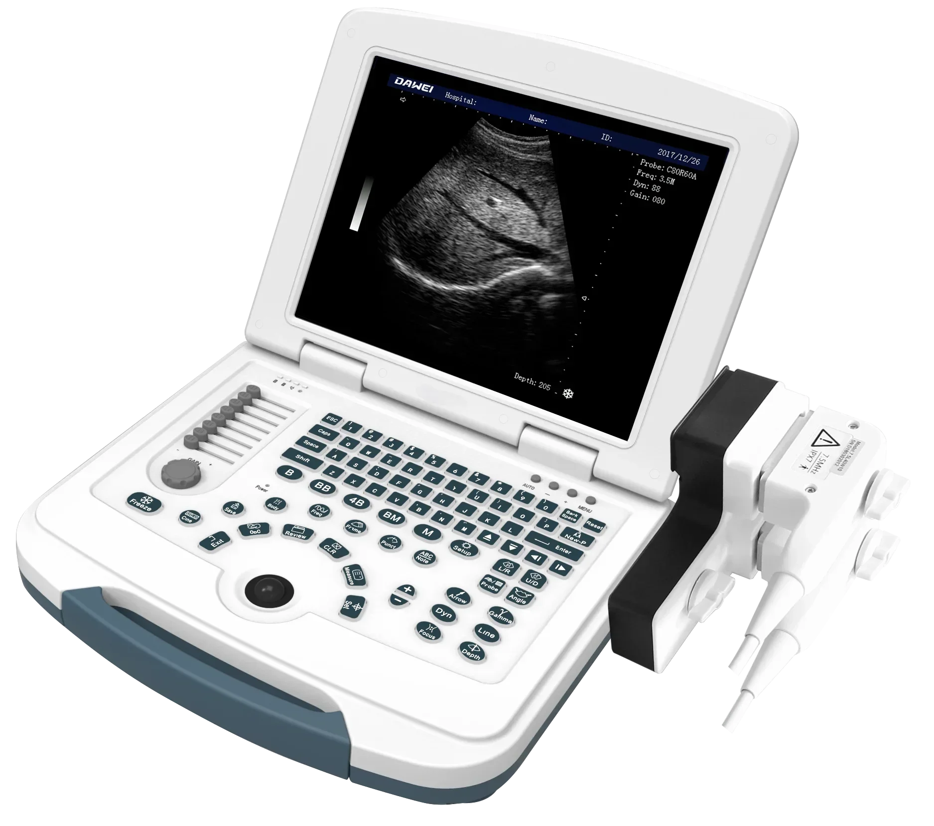 Portable Full Digital B/W Laptop Ultrasound Machine for Veterinary Animal  with Probes