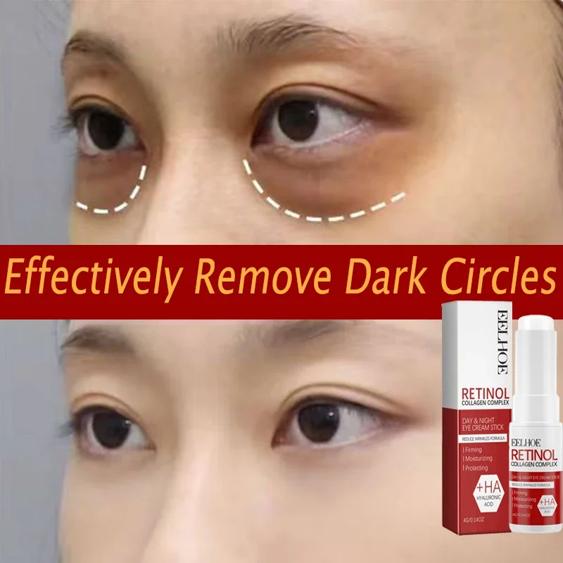 

Retinol Eye Cream Collagen Multibalm Stick Reduce Wrinkles Eye Hyaluronic Acid Anti Dark Circle Puffiness Firming Eye Care