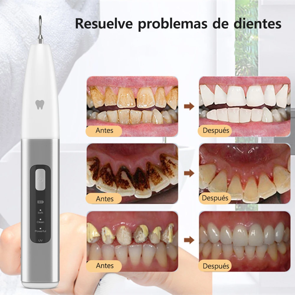 Eliminación ultrasónica de sarro Dental, eliminador de sarro Dental, escalador Dental, eliminador de placa y cálculo, limpiador de sarro Dental ultrasónico