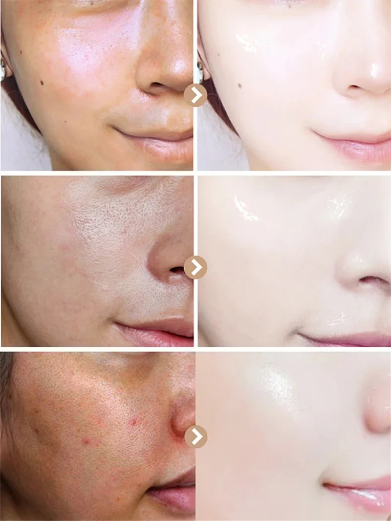 米と蜂蜜のクレンジングフェイスマスク、ブライトニング美容液、化粧水、保湿ブライトニングオイルコントロールギフトセット、女性用スキンケア、韓国製