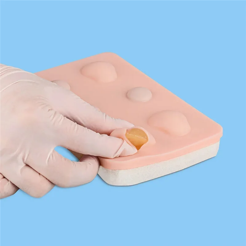 For Ultrassist Abscess For Skin Pad Sebaceous Cyst Removal Practice Module Resection Skin Tumor