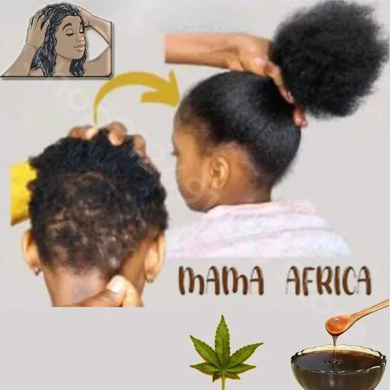 300ml Africa Women Traction Alopecia Treatment Hair Growth Product for Men Shampoo Hair Loss Treatment Get Rid of Wigs