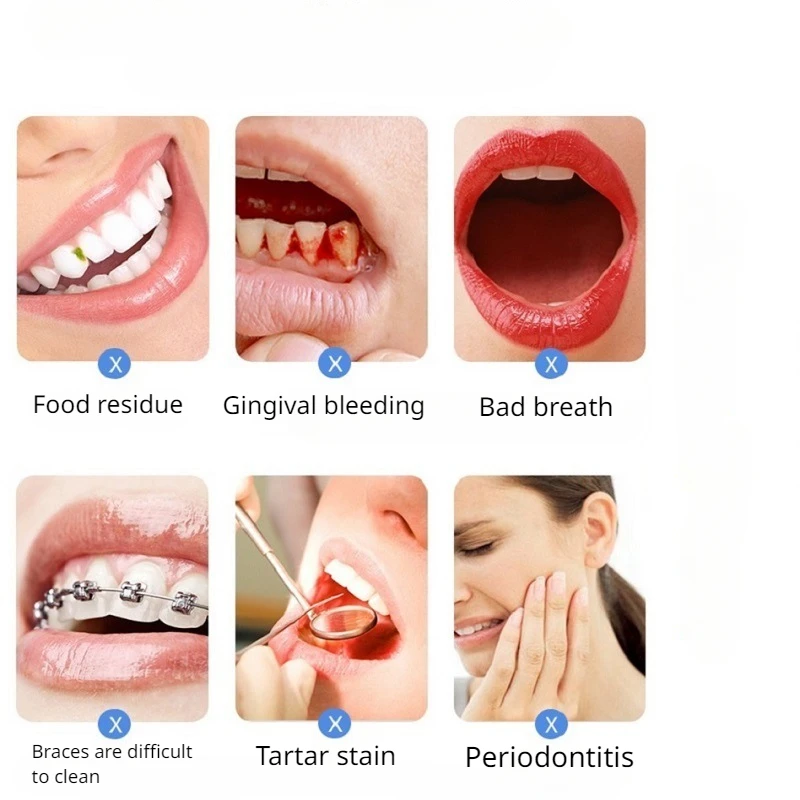 Limpiador Dental inteligente eléctrico, equipo de limpieza Dental portátil con chorro de agua, instrumento de cuidado bucal