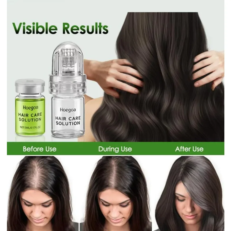 Hair Essential Care Serum Strengthen Roots Reducing Loss Hair Regrowth System Advanced Hair Growth Ampoule Serum Conditioner