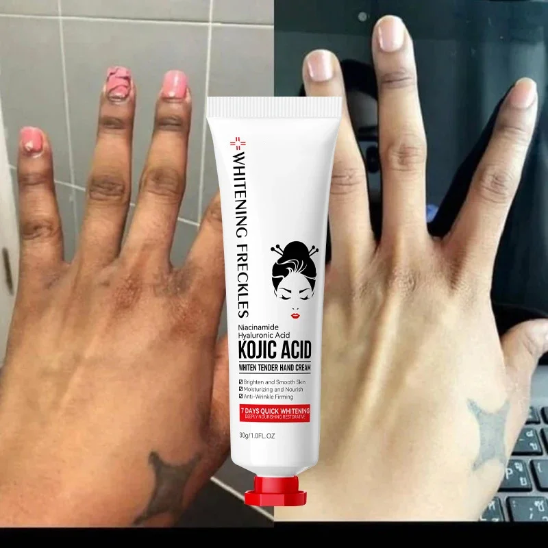 Kojic Acid Fade Dull Hand Cream Body Fast Smooth Nourish Cream Lightening Black Skin Brightening Moisturizing Korean Skin Care