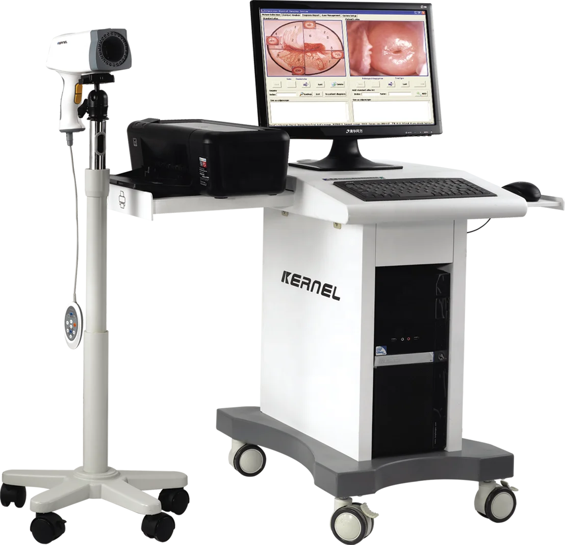 Video Imaging For Women Gynecological Examination Digital Vaginal Examination Equipment With  HD Printer