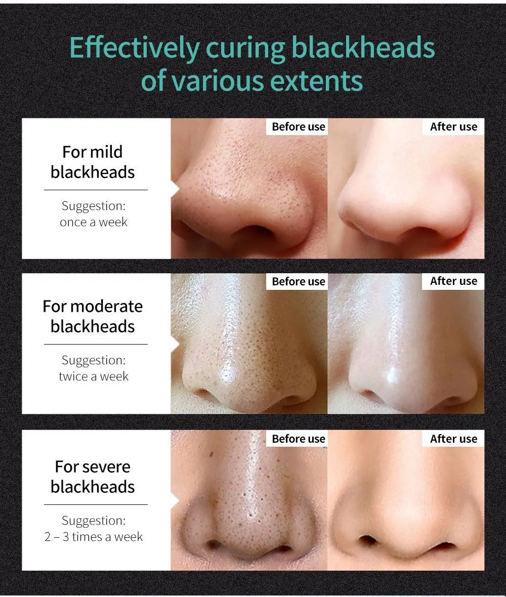 60g 뷰티 스킨케어 껍질 벗기기 검은 코 검은 점 제거 페이스 케어 블랙헤드 리무버 대나무 숯