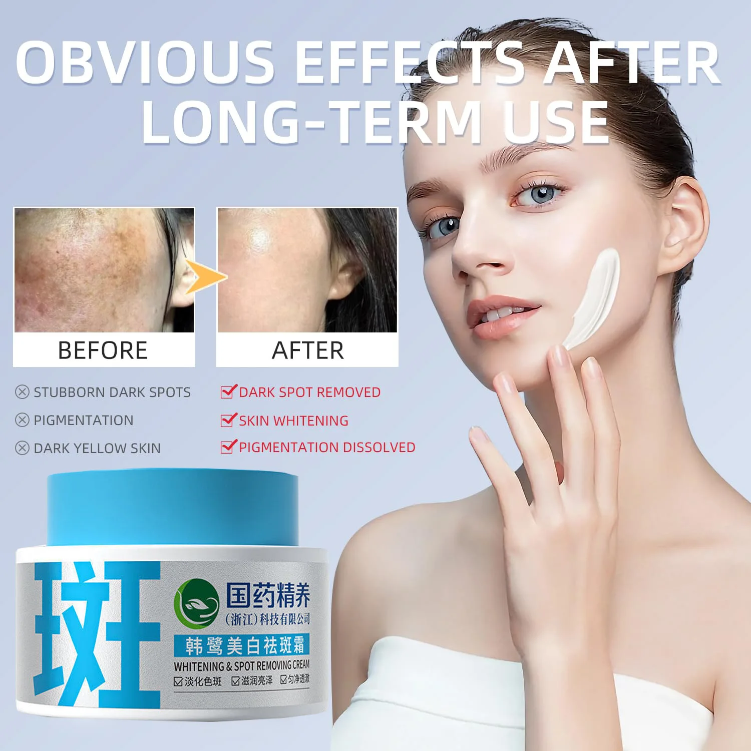 50g Whitening Freckles Cream Remove Melasma Dark Spots Corrector Lighten Melanin Pigmentation Brightening Skin Uneven Skin Tone