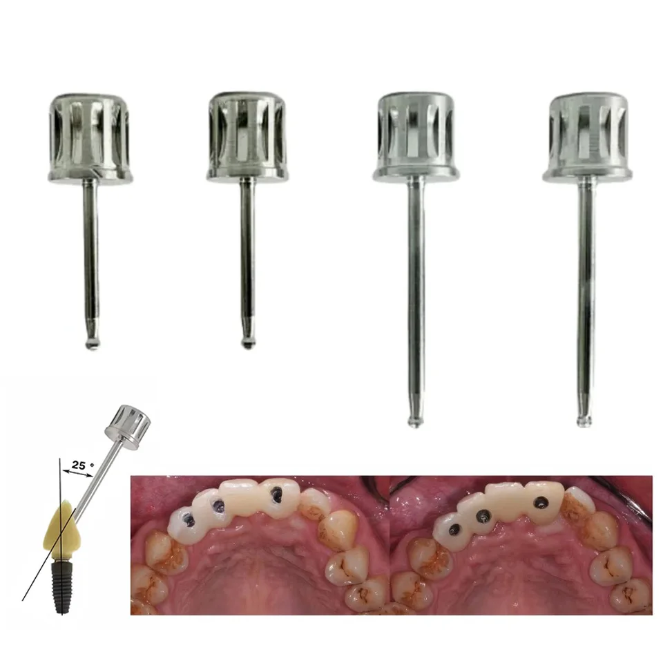 Dental Lab Angulated Screw Channel ASC Screwdriver 15mm 20mm for Implant Restoration fit Osstem MIS Dentium ITI NOB Systems Pro