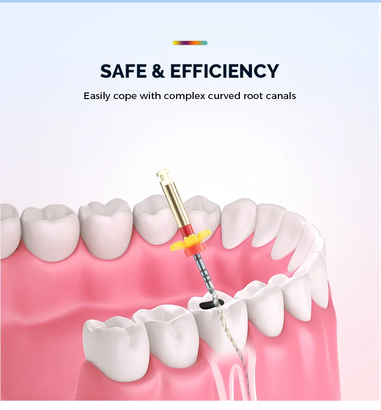 5 Boxen AZDENT Dental Endodontische Wurzelkanalfeilen Super Rainbow Files 25mm Thermisch Aktivierte NITI Flexible Zahnärztliche Feilen – Detail 4