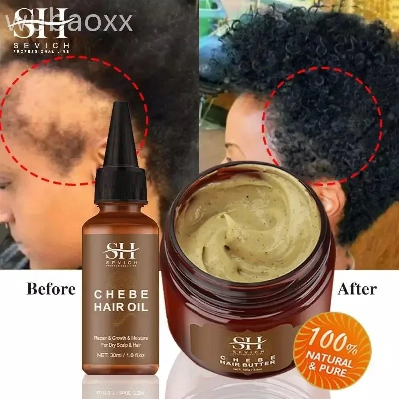 

Fast Hair Growth Set Chebe Oil Traction Alopecia Anti Break Hair Mask Loss Hair Growth Oil Baldness Treatment Hair Care Products