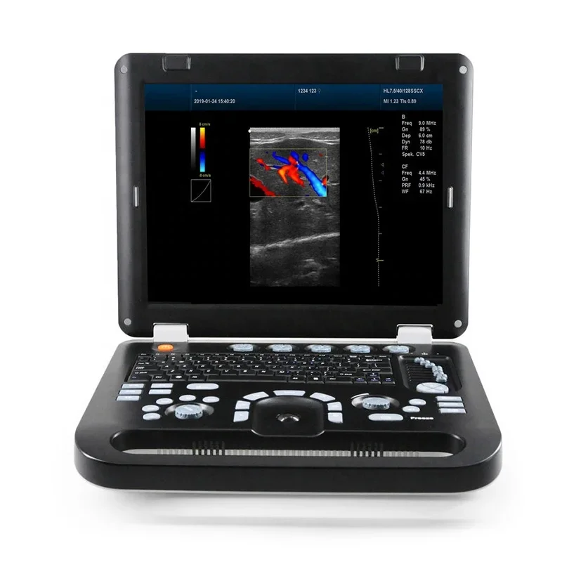 China Medical  Laptop 3D 4D Color Doppler Portable Ultrasound Scanner Machine Price