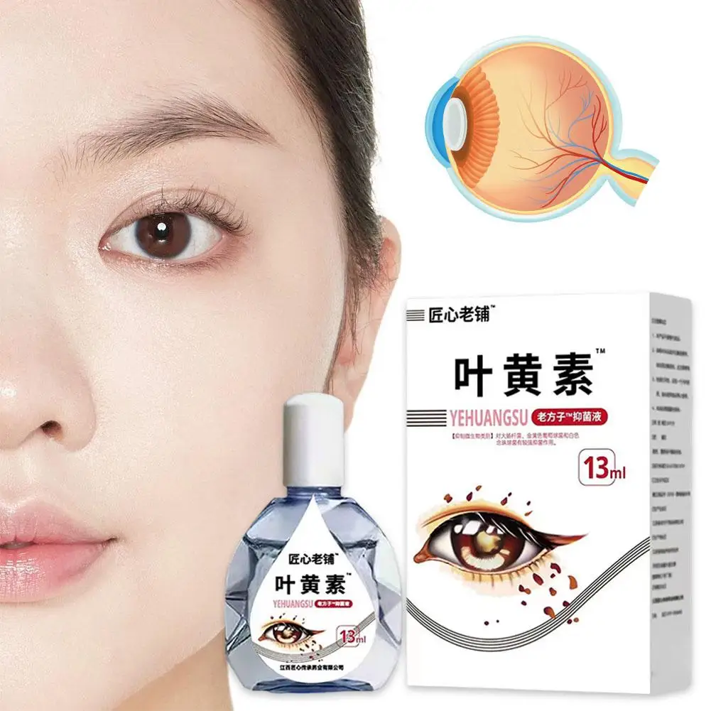 Lutein Eye Drops Relieve Eye Fatigue Dryness Improve Vision Eye Care For Shadow Cloudy Blurred Vision Drops B6 For Elderly J8Q2