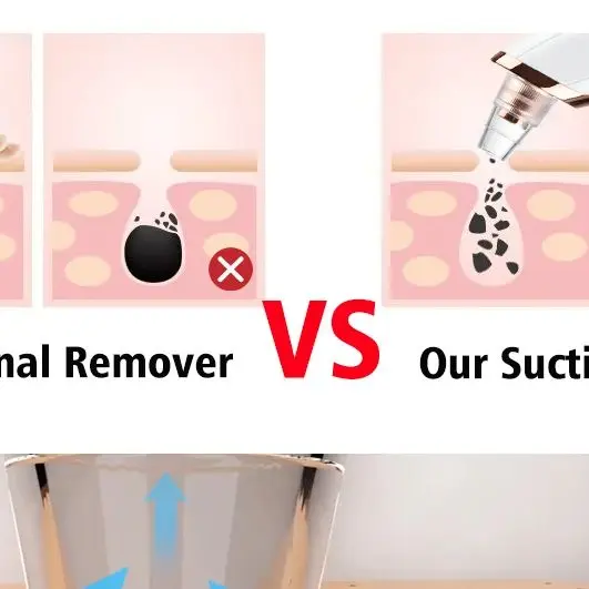 Aspirapolvere elettrico per la rimozione dei punti neri Rimozione delle macchie nere Pulizia profonda del viso Macchina per la pulizia dei pori Strumenti per la cura della pelle del viso