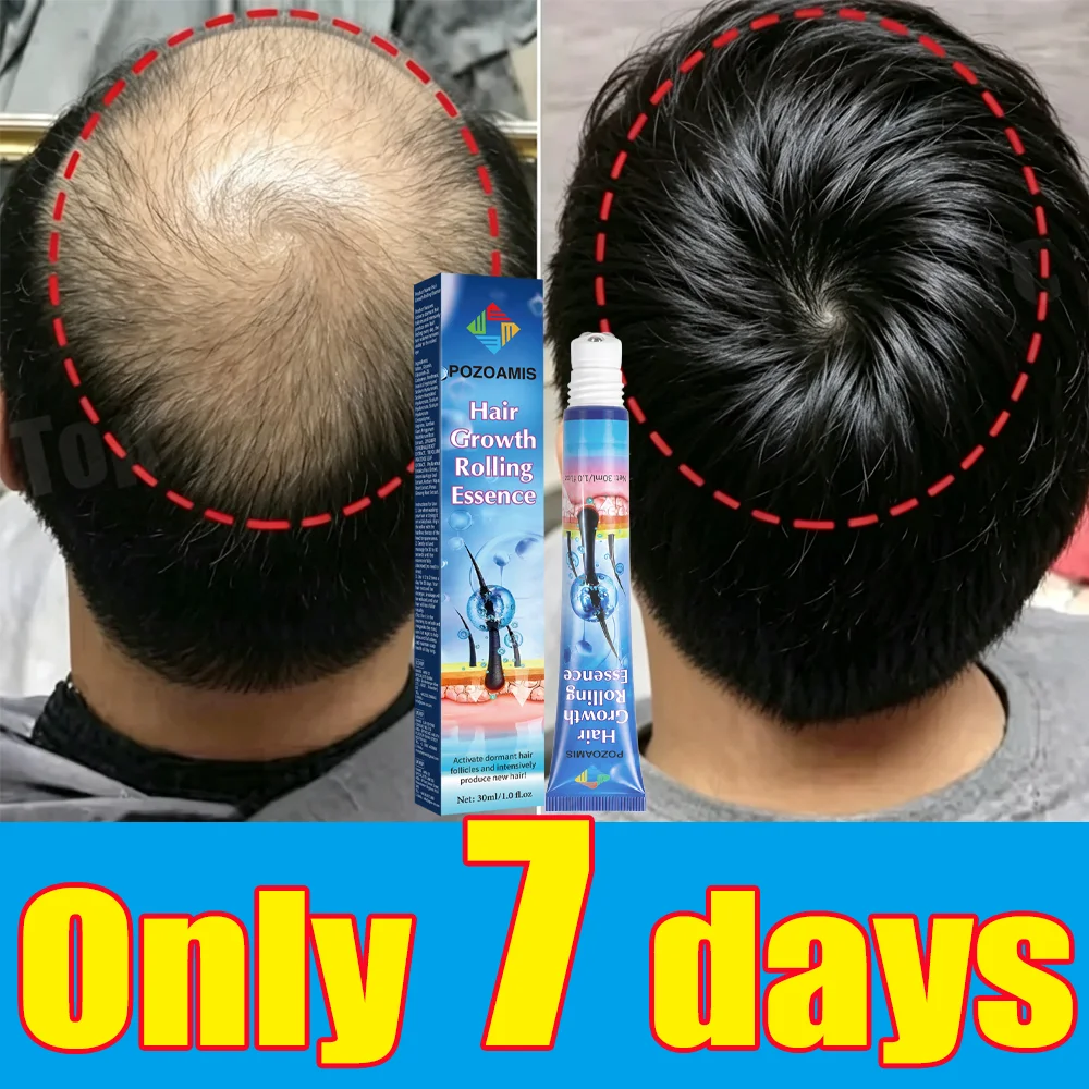 Add To Your Hair Routine, Boost Root Condition，Reduce Thin Hair Look.