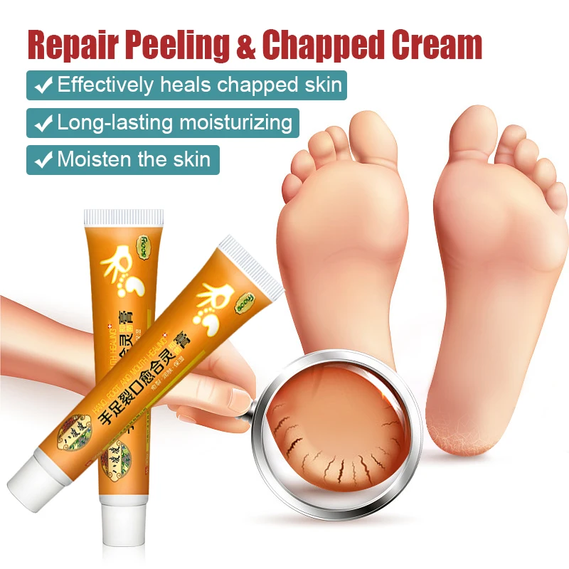 1pcs Foot Chap Treatment Cream Repair Hand Heel Chap Moisturizing Cream Frostbite Reduce Wrinkle Skin Dry Itch Skin Care S012