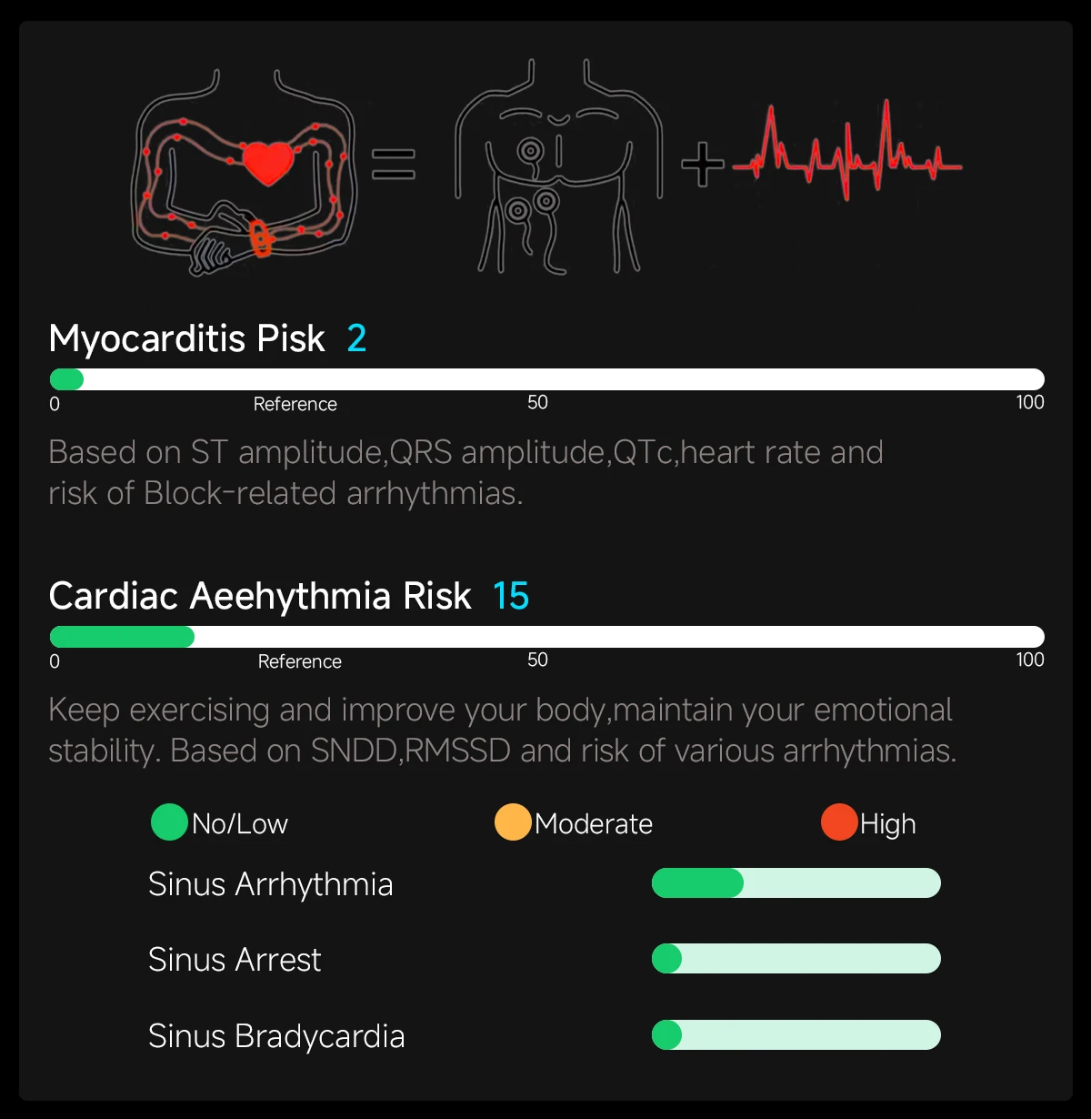 2026 Neue KI-gestützte EKG-Smartwatch in medizinischer Qualität mit 1,53'' Saphirglas, Herzfrequenz-, Blutfett- und Harnsäure-Monitor, Bluetooth-Anruffunktion – Detail 13