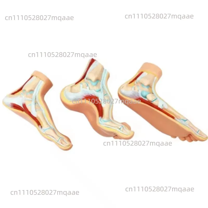 Foot Pathology Model Normal/Flat/High Arch Foot Anatomy with Muscles Bones Medical Teaching Display for Podiatry Education