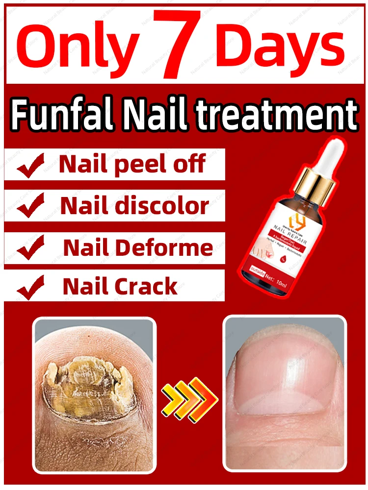 

Solve the nails problems