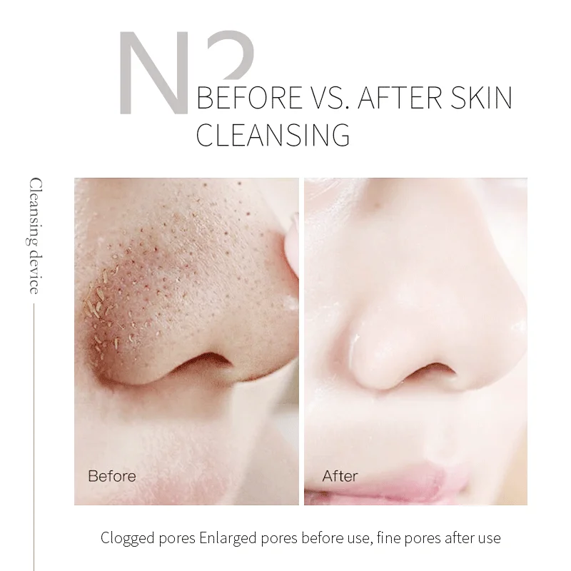 Professional Pore Cleansing Beauty Device Deep cleaning Removes Blackheads Remove Grease Delicate Pore Improve Skin Condition