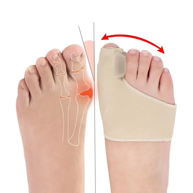 2 PCS Hallux Valgus Silicone Protective Cover Big Toe Valgus Fixator Toe Valgus Corrector Bunion Splitter