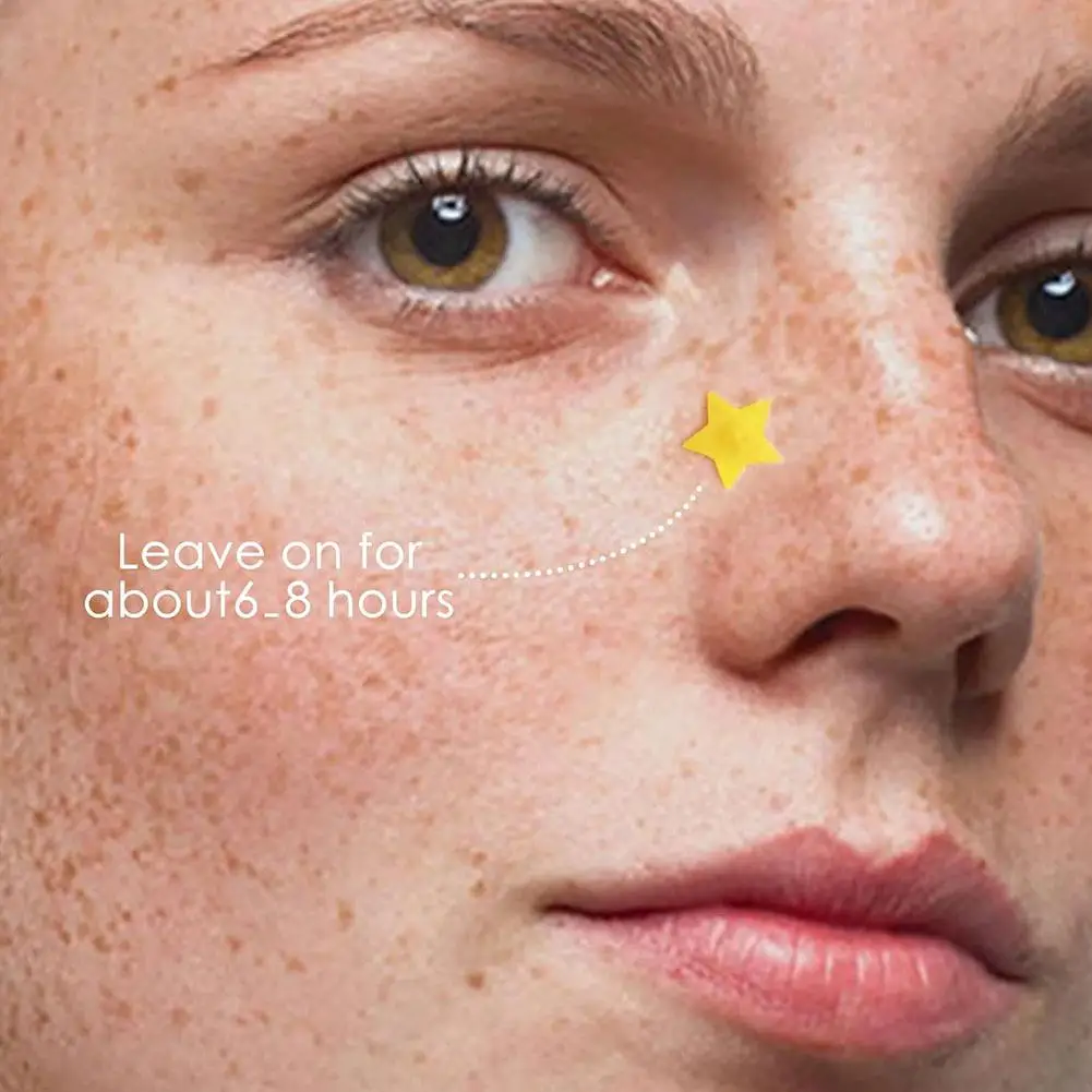 600 st Acne Patches Vijf kleuren Gemengde Ster Puistje Patch Smet Cover Acne Verwijderen Concealer Gezicht Spot Make-Up Tool Huidverzorging sticker