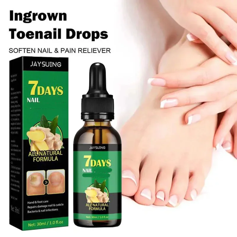 Nail 𝐅𝐮𝐧𝐠𝐮𝐬 𝐓𝐫𝐞𝐚𝐭𝐦𝐞𝐧𝐭 𝐎𝐧𝐲𝐜𝐡𝐨𝐦𝐲𝐜𝐨𝐬𝐢𝐬 𝐑𝐞𝐩𝐚𝐢𝐫 Herbaceous Essential oil For 𝐏𝐚𝐫𝐨𝐧𝐲𝐜𝐡𝐢𝐚