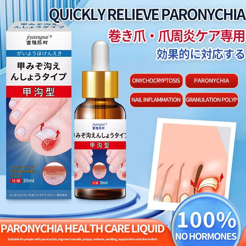 Jiyatengnai نوع الأخدود للأظافر محلول الرعاية الصحية الخارجية يهدئ أظافر القدم الغامضة والانتفاخ والازعاج حل مسحة الرعاية الخارجية