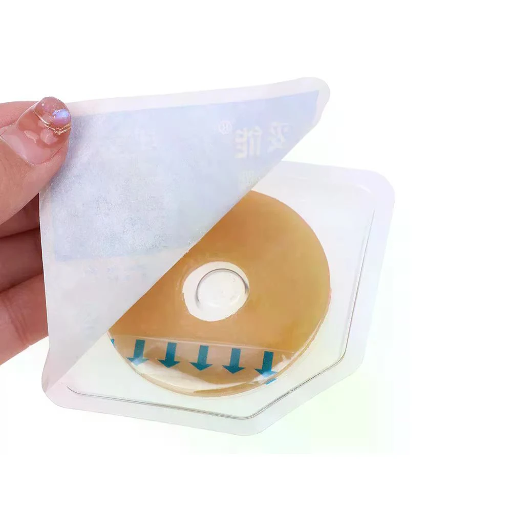 5-50Pcs Portable 2/4mm Colostomy Bags Anti-leak Ring For Stoma Bags Supplies Protective Barrier Rings Ostomy Bag Assistance
